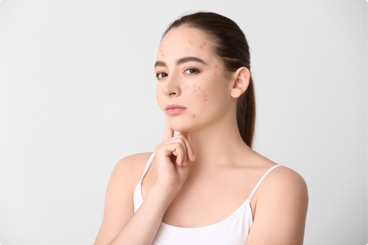 Viêm da, mụn nhọt, viêm nhiễm ở phụ nữ 7 Viêm da, mụn nhọt, viêm nhiễm ở phụ nữ